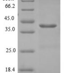 SDS-PAGE separation of QP5928 followed by commassie total protein stain results in a primary band consistent with reported data for Density-regulated protein. These data demonstrate Greater than 90% as determined by SDS-PAGE.