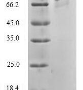 SDS-PAGE separation of QP5930 followed by commassie total protein stain results in a primary band consistent with reported data for Diacylglycerol kinase alpha. These data demonstrate Greater than 80% as determined by SDS-PAGE.