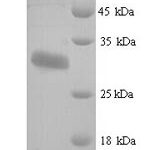 SDS-PAGE separation of QP5937 followed by commassie total protein stain results in a primary band consistent with reported data for Protein delta homolog 1. These data demonstrate Greater than 90% as determined by SDS-PAGE.