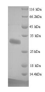 SDS-PAGE separation of QP5937 followed by commassie total protein stain results in a primary band consistent with reported data for Protein delta homolog 1. These data demonstrate Greater than 90% as determined by SDS-PAGE.