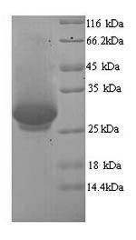 SDS-PAGE separation of QP5939 followed by commassie total protein stain results in a primary band consistent with reported data for Dynamin-1. These data demonstrate Greater than 90% as determined by SDS-PAGE.