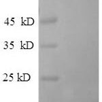 SDS-PAGE separation of QP5945 followed by commassie total protein stain results in a primary band consistent with reported data for Dipeptidyl aminopeptidase-like protein 6. These data demonstrate Greater than 90% as determined by SDS-PAGE.