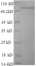 SDS-PAGE separation of QP5945 followed by commassie total protein stain results in a primary band consistent with reported data for Dipeptidyl aminopeptidase-like protein 6. These data demonstrate Greater than 90% as determined by SDS-PAGE.