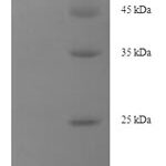 SDS-PAGE separation of QP5951 followed by commassie total protein stain results in a primary band consistent with reported data for Desmoglein-3. These data demonstrate Greater than 90% as determined by SDS-PAGE.