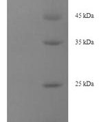 SDS-PAGE separation of QP5951 followed by commassie total protein stain results in a primary band consistent with reported data for Desmoglein-3. These data demonstrate Greater than 90% as determined by SDS-PAGE.