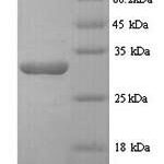 SDS-PAGE separation of QP5952 followed by commassie total protein stain results in a primary band consistent with reported data for Desmoplakin. These data demonstrate Greater than 80% as determined by SDS-PAGE.