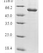 SDS-PAGE separation of QP5955 followed by commassie total protein stain results in a primary band consistent with reported data for Thymidylate kinase. These data demonstrate Greater than 80% as determined by SDS-PAGE.