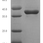 SDS-PAGE separation of QP5956 followed by commassie total protein stain results in a primary band consistent with reported data for Thymidylate kinase. These data demonstrate Greater than 90% as determined by SDS-PAGE.