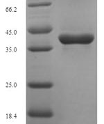 SDS-PAGE separation of QP5956 followed by commassie total protein stain results in a primary band consistent with reported data for Thymidylate kinase. These data demonstrate Greater than 90% as determined by SDS-PAGE.