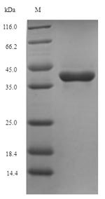 SDS-PAGE separation of QP5956 followed by commassie total protein stain results in a primary band consistent with reported data for Thymidylate kinase. These data demonstrate Greater than 90% as determined by SDS-PAGE.