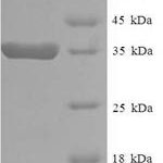 SDS-PAGE separation of QP5961 followed by commassie total protein stain results in a primary band consistent with reported data for EEF1E1 / AIMP3 / p18. These data demonstrate Greater than 90% as determined by SDS-PAGE.