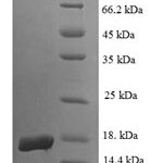 SDS-PAGE separation of QP5968 followed by commassie total protein stain results in a primary band consistent with reported data for Egl nine homolog 2. These data demonstrate Greater than 90% as determined by SDS-PAGE.