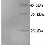 SDS-PAGE separation of QP5969 followed by commassie total protein stain results in a primary band consistent with reported data for EIF2AK2. These data demonstrate Greater than 90% as determined by SDS-PAGE.