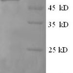 SDS-PAGE separation of QP5975 followed by commassie total protein stain results in a primary band consistent with reported data for EIF4G1. These data demonstrate Greater than 90% as determined by SDS-PAGE.