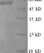 SDS-PAGE separation of QP5975 followed by commassie total protein stain results in a primary band consistent with reported data for EIF4G1. These data demonstrate Greater than 90% as determined by SDS-PAGE.
