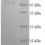 SDS-PAGE separation of QP5976 followed by commassie total protein stain results in a primary band consistent with reported data for EIF-5A / EIF5. These data demonstrate Greater than 90% as determined by SDS-PAGE.