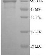SDS-PAGE separation of QP5976 followed by commassie total protein stain results in a primary band consistent with reported data for EIF-5A / EIF5. These data demonstrate Greater than 90% as determined by SDS-PAGE.