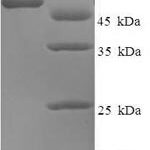 SDS-PAGE separation of QP5978 followed by commassie total protein stain results in a primary band consistent with reported data for Neutrophil elastase. These data demonstrate Greater than 90% as determined by SDS-PAGE.