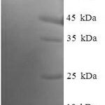 SDS-PAGE separation of QP5982 followed by commassie total protein stain results in a primary band consistent with reported data for EML2. These data demonstrate Greater than 90% as determined by SDS-PAGE.