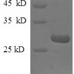 SDS-PAGE separation of QP5991 followed by commassie total protein stain results in a primary band consistent with reported data for Epiplakin. These data demonstrate Greater than 90% as determined by SDS-PAGE.