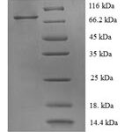 SDS-PAGE separation of QP5993 followed by commassie total protein stain results in a primary band consistent with reported data for HER2 / ErbB2. These data demonstrate Greater than 90% as determined by SDS-PAGE.