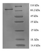 SDS-PAGE separation of QP5993 followed by commassie total protein stain results in a primary band consistent with reported data for HER2 / ErbB2. These data demonstrate Greater than 90% as determined by SDS-PAGE.