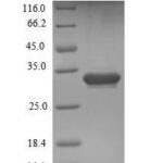 SDS-PAGE separation of QP5997 followed by commassie total protein stain results in a primary band consistent with reported data for ESM1 / Endocan. These data demonstrate Greater than 90% as determined by SDS-PAGE.