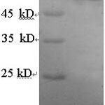 SDS-PAGE separation of QP6000 followed by commassie total protein stain results in a primary band consistent with reported data for Estrogen Receptor 2. These data demonstrate Greater than 90% as determined by SDS-PAGE.