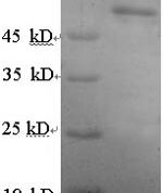 SDS-PAGE separation of QP6000 followed by commassie total protein stain results in a primary band consistent with reported data for Estrogen Receptor 2. These data demonstrate Greater than 90% as determined by SDS-PAGE.