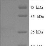 SDS-PAGE separation of QP6003 followed by commassie total protein stain results in a primary band consistent with reported data for ETFDH. These data demonstrate Greater than 85.3% as determined by SDS-PAGE.