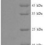 SDS-PAGE separation of QP6005 followed by commassie total protein stain results in a primary band consistent with reported data for Eyes absent homolog 2. These data demonstrate Greater than 90% as determined by SDS-PAGE.