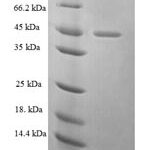 SDS-PAGE separation of QP6006 followed by commassie total protein stain results in a primary band consistent with reported data for EZR / VIL2 / Ezrin. These data demonstrate Greater than 90% as determined by SDS-PAGE.