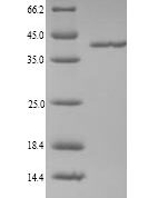 SDS-PAGE separation of QP6008 followed by commassie total protein stain results in a primary band consistent with reported data for Coagulation factor XII. These data demonstrate Greater than 90% as determined by SDS-PAGE.