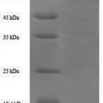 SDS-PAGE separation of QP6009 followed by commassie total protein stain results in a primary band consistent with reported data for Coagulation Factor II / FII / F2. These data demonstrate Greater than 90% as determined by SDS-PAGE.