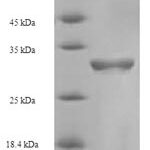 SDS-PAGE separation of QP6011 followed by commassie total protein stain results in a primary band consistent with reported data for Coagulation factor V. These data demonstrate Greater than 90% as determined by SDS-PAGE.