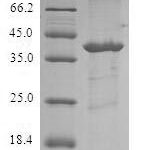 SDS-PAGE separation of QP6014 followed by commassie total protein stain results in a primary band consistent with reported data for FABP5 / E-FABP. These data demonstrate Greater than 80% as determined by SDS-PAGE.