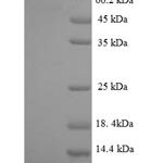 SDS-PAGE separation of QP6019 followed by commassie total protein stain results in a primary band consistent with reported data for Fanconi anemia group C protein. These data demonstrate Greater than 90% as determined by SDS-PAGE.