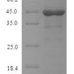 SDS-PAGE separation of QP6026 followed by commassie total protein stain results in a primary band consistent with reported data for FcERI / FCER1A. These data demonstrate Greater than 90% as determined by SDS-PAGE.