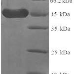 SDS-PAGE separation of QP6029 followed by commassie total protein stain results in a primary band consistent with reported data for CD23 / FCER2 / FCER2A. These data demonstrate Greater than 90% as determined by SDS-PAGE.