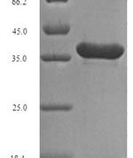 SDS-PAGE separation of QP6040 followed by commassie total protein stain results in a primary band consistent with reported data for FGF10 / KGF2 Protein. These data demonstrate Greater than 85% as determined by SDS-PAGE.