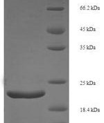 SDS-PAGE separation of QP6044 followed by commassie total protein stain results in a primary band consistent with reported data for FGF21 / Fibroblast Growth Factor 21. These data demonstrate Greater than 90% as determined by SDS-PAGE.
