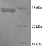 SDS-PAGE separation of QP6063 followed by commassie total protein stain results in a primary band consistent with reported data for GADD45A / DDIT-1. These data demonstrate Greater than 90% as determined by SDS-PAGE.