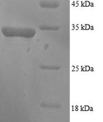 SDS-PAGE separation of QP6063 followed by commassie total protein stain results in a primary band consistent with reported data for GADD45A / DDIT-1. These data demonstrate Greater than 90% as determined by SDS-PAGE.