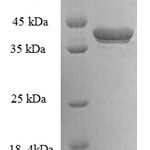 SDS-PAGE separation of QP6065 followed by commassie total protein stain results in a primary band consistent with reported data for G antigen 5. These data demonstrate Greater than 90% as determined by SDS-PAGE.