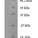 SDS-PAGE separation of QP6066 followed by commassie total protein stain results in a primary band consistent with reported data for N-acetylgalactosamine-6-sulfatase. These data demonstrate Greater than 90% as determined by SDS-PAGE.