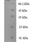 SDS-PAGE separation of QP6066 followed by commassie total protein stain results in a primary band consistent with reported data for N-acetylgalactosamine-6-sulfatase. These data demonstrate Greater than 90% as determined by SDS-PAGE.