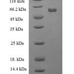 SDS-PAGE separation of QP6067 followed by commassie total protein stain results in a primary band consistent with reported data for Galactose-1-phosphate uridylyltransferase. These data demonstrate Greater than 90% as determined by SDS-PAGE.