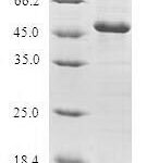 SDS-PAGE separation of QP6072 followed by commassie total protein stain results in a primary band consistent with reported data for Grancalcin. These data demonstrate Greater than 80% as determined by SDS-PAGE.