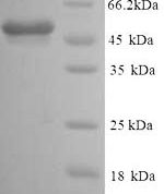 SDS-PAGE separation of QP6079 followed by commassie total protein stain results in a primary band consistent with reported data for GFAP. These data demonstrate Greater than 80% as determined by SDS-PAGE.