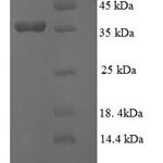 SDS-PAGE separation of QP6080 followed by commassie total protein stain results in a primary band consistent with reported data for GGCT. These data demonstrate Greater than 90% as determined by SDS-PAGE.